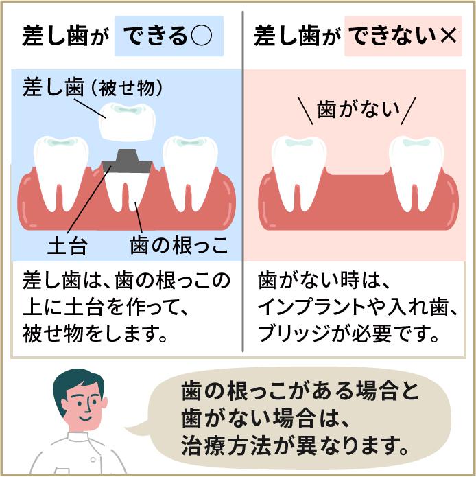 差し歯のメリットとデメリット