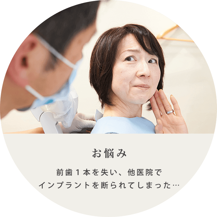 インプラント治療の例