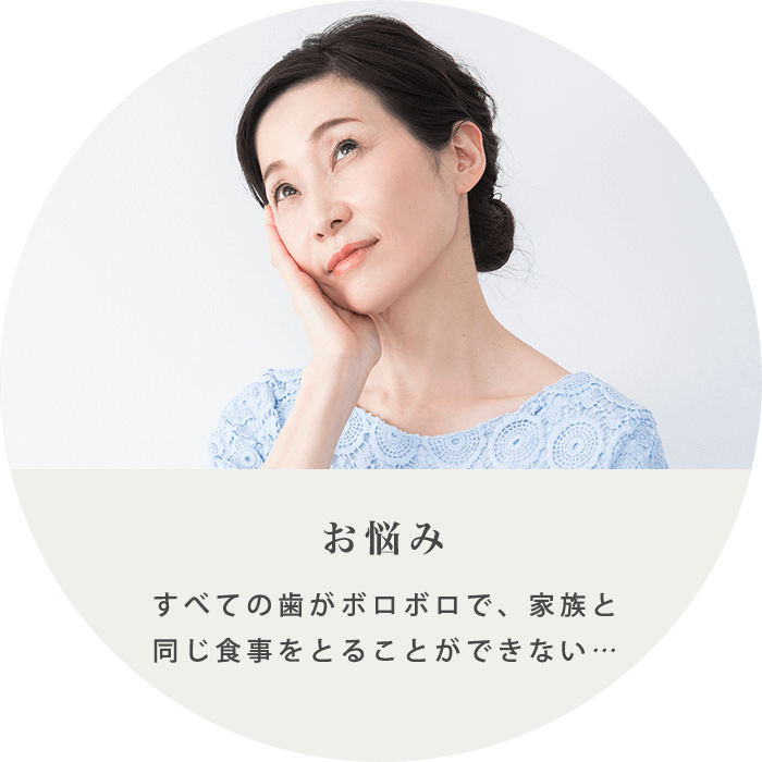 インプラント治療の例