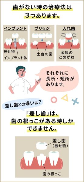 歯がない時の治療法