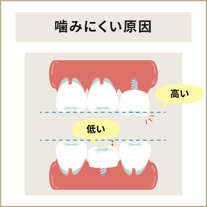 噛みにくい原因