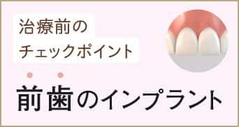 前歯のインプラントの治療前のチェックポイント