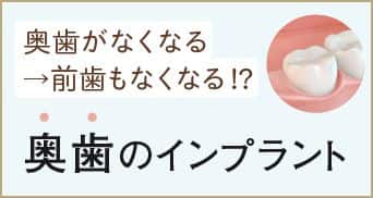 奥歯のインプラントの大切さ