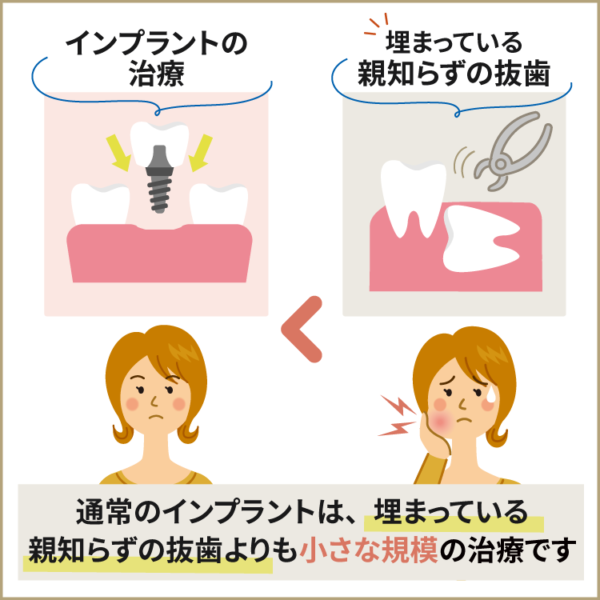 インプラントは親知らずの抜歯よりも小規模な治療