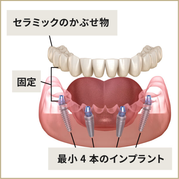 オールオン４ allon4