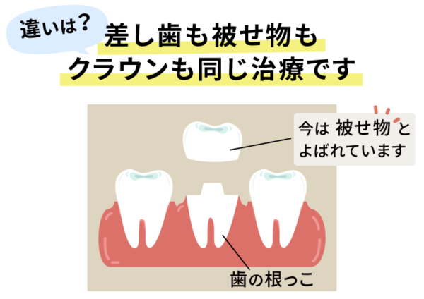 差し歯、被せ物、クラウンの違い