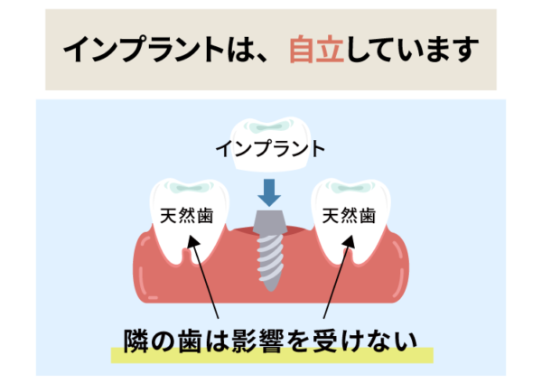 インプラントは自立・独立しています