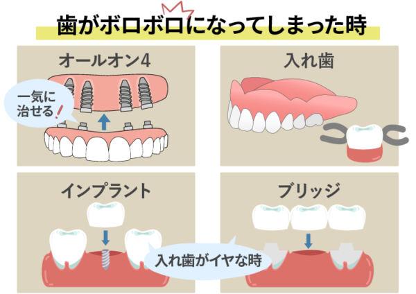 ボロボロの歯の治療方法