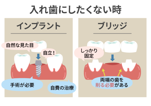 入れ歯にしたくない時の治療