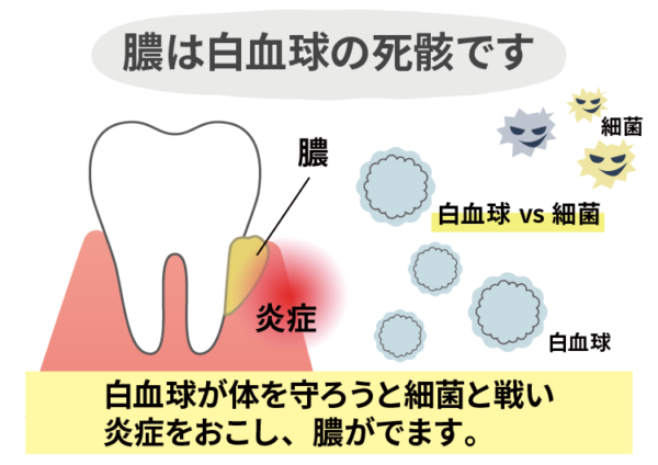 膿は白血球の死骸