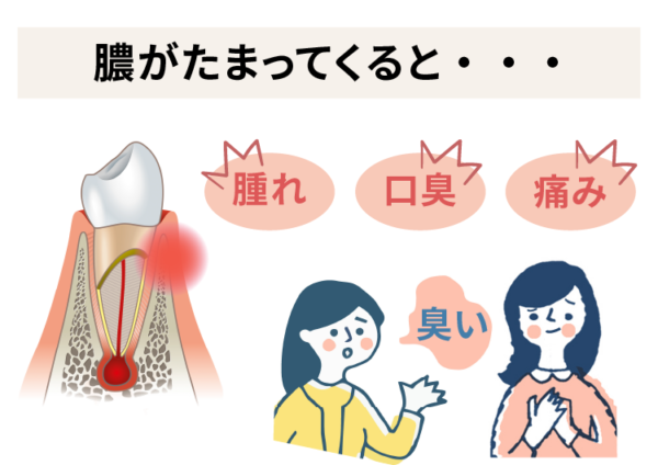 膿が溜まってくると口臭