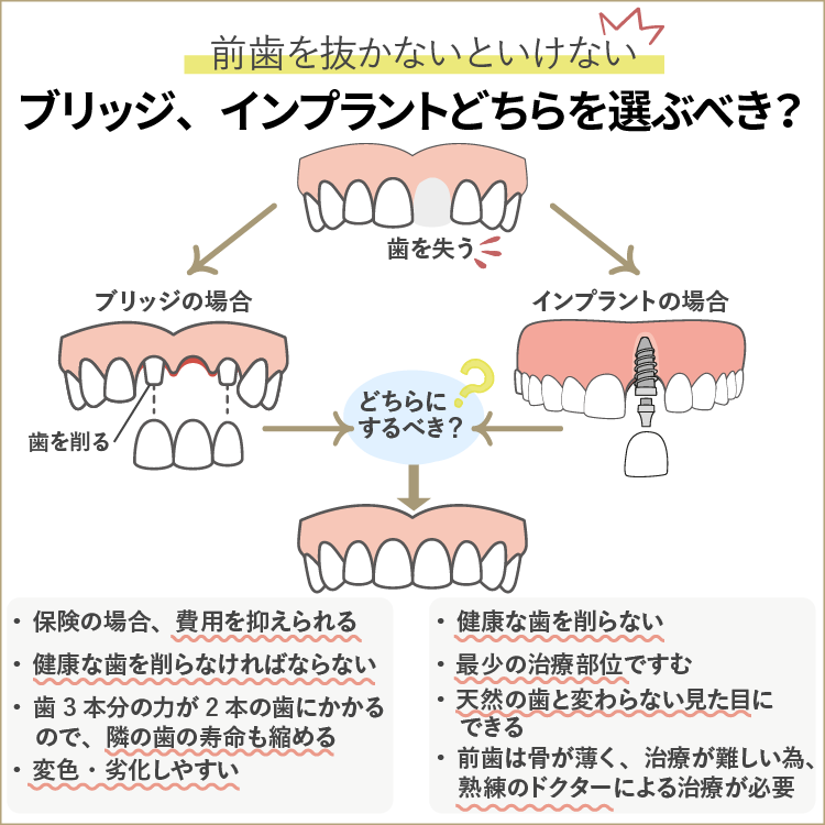 前歯の役割