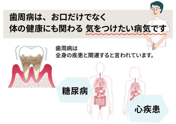 歯周病と全身疾患