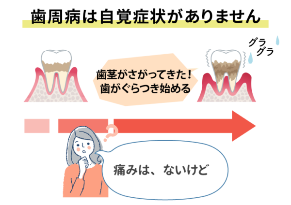 歯周病は自覚症状がありません