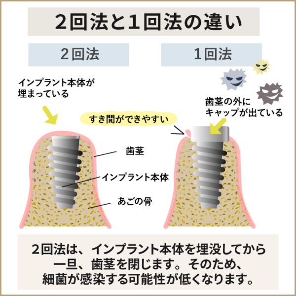 2回法と1回法の違い