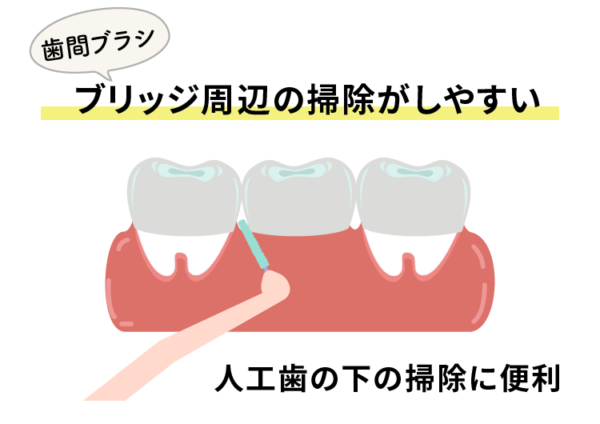 ブリッジの掃除