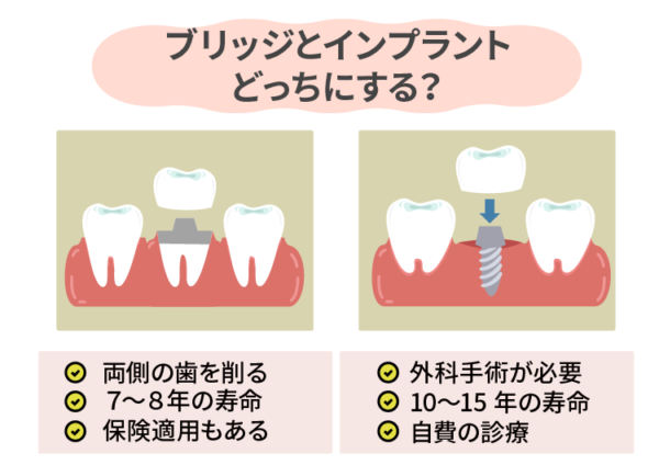 ブリッジvs.インプラント